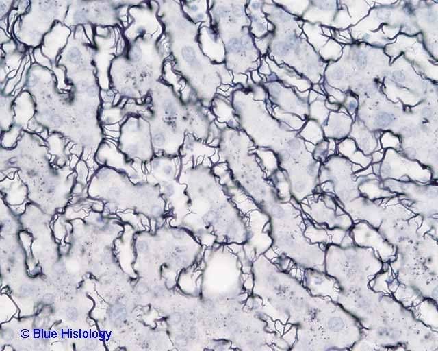 CT Reticular fibers silver stain