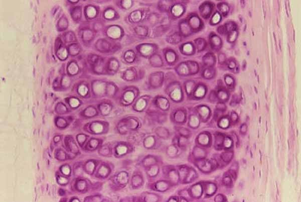 CT Hyaline cartilage