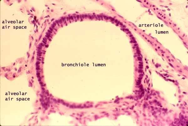 LR bronchiole labeled