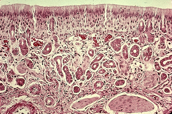 UR Bowman's Glands