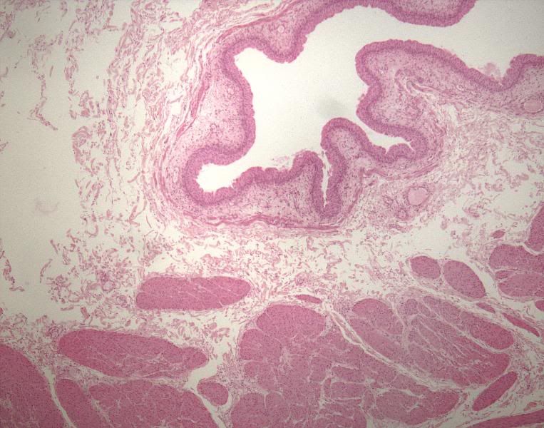 bladder transitional epithelium