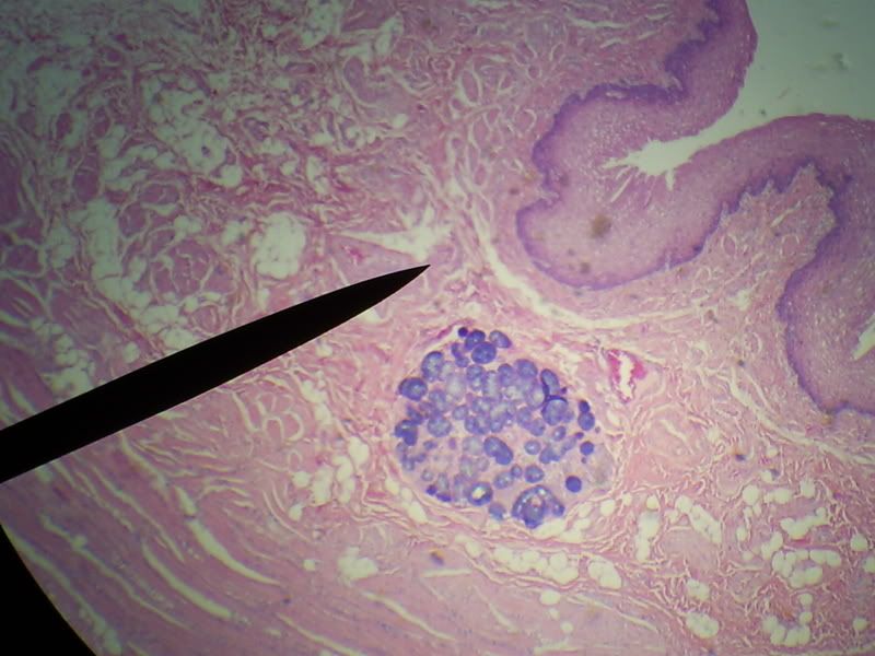 Esophageal gland