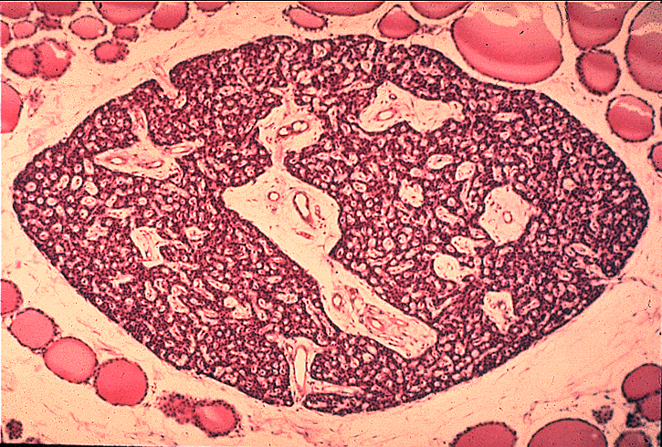 parathyroid panoramic view