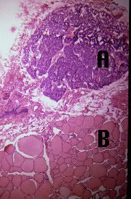 parathyroid chief cells