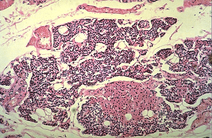 parathyroid oxyphil and chief cells
