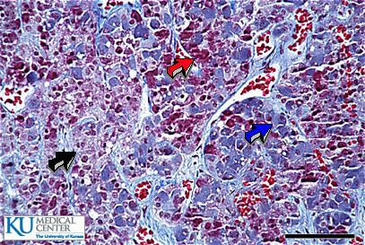 anterior pituitary