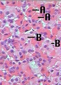 pituitary chromophils and chromophobes