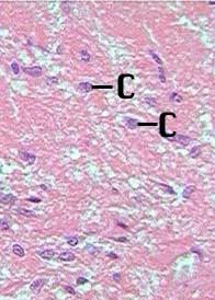 posterior pituitary pars neurvosa