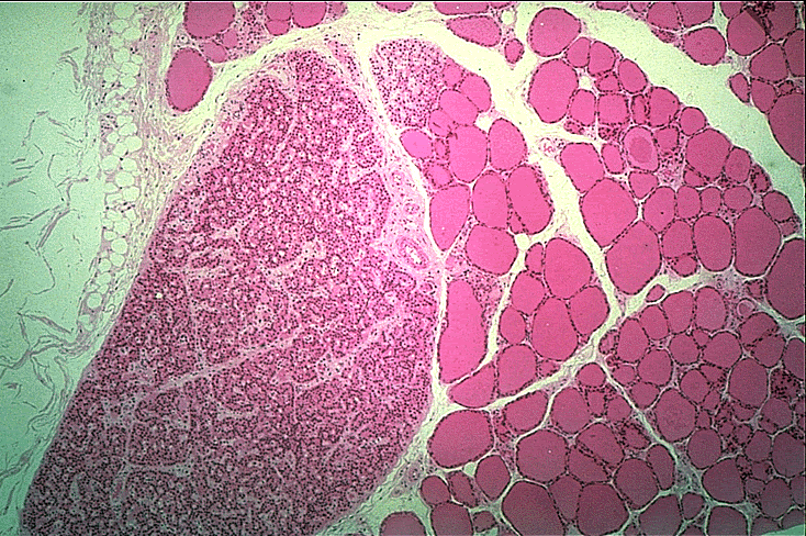 thyroid and parathyroid