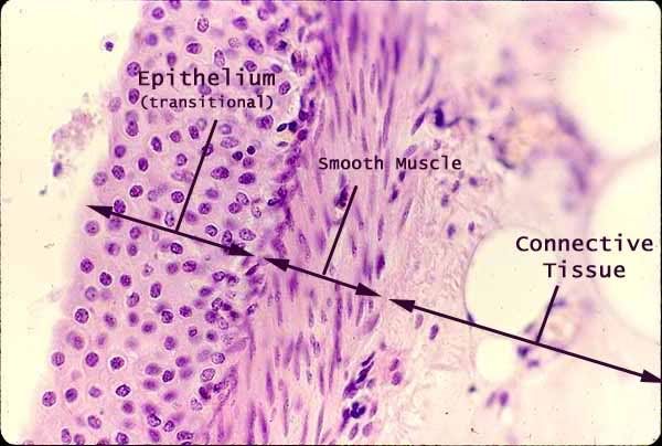 Transitional epithelium