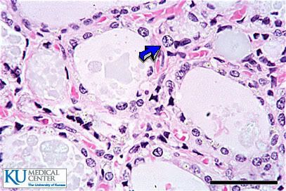 Parathyroid Histology