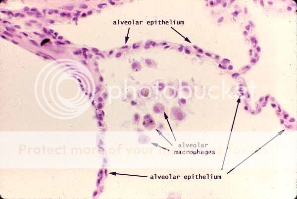 Simple Squamous Alveolar Epithelium Photo by lovesthesunset | Photobucket